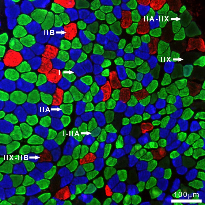 Myosin Heavy Chain Type IIB Antibody (BF-F3) - DSHB
